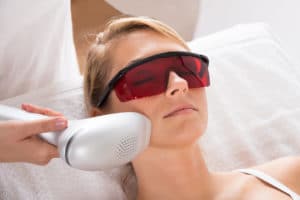 best laser hair removal